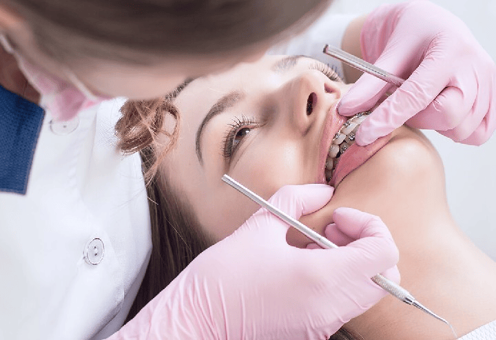 A dentist placing a restorative filling at Annandale Dental Care
